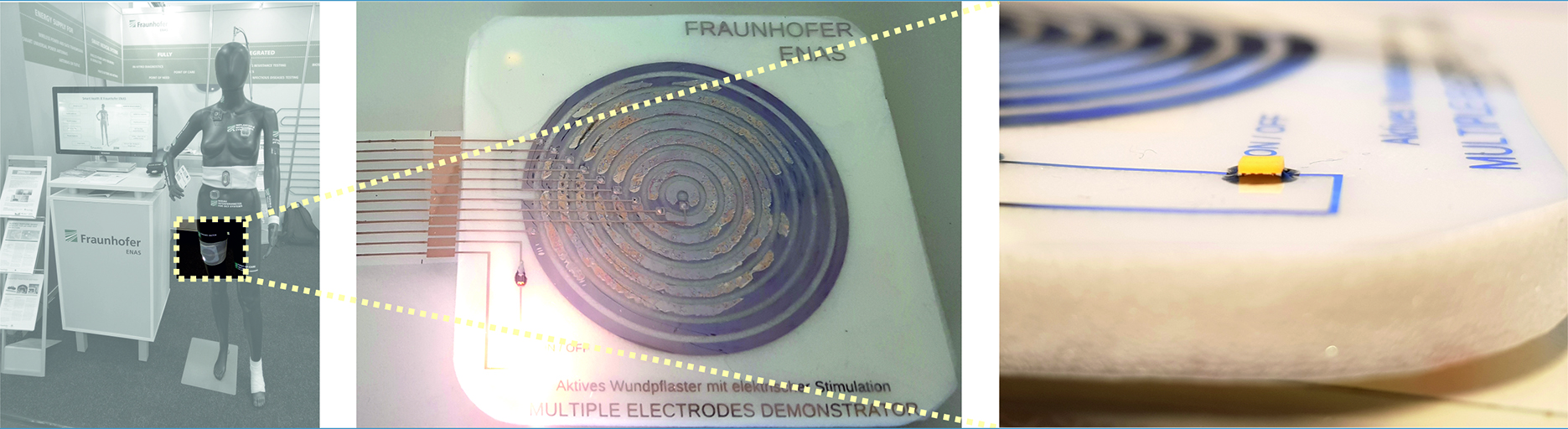 Technologiedemonstrator für ein elektrisch aktives Wundpflaster mit gedruckten Elektroden auf flexiblen Substraten.